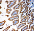 Anti-EpCAM Antibody