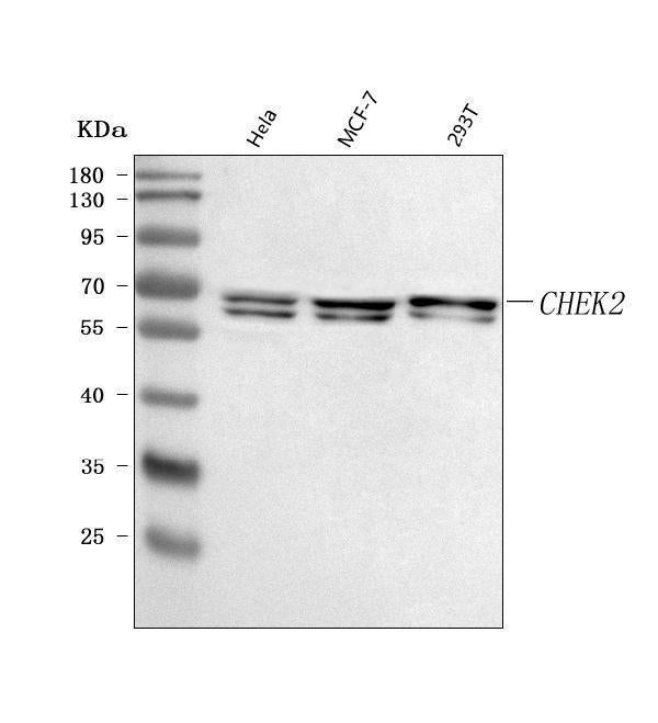Anti-CHEK2 Antibody Picoband®