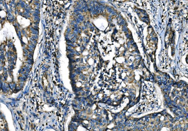 Anti-CX3CR1 Antibody
