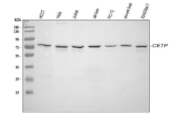 Anti-CETP Antibody Picoband®