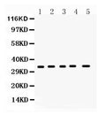 Anti-Superoxide Dismutase 4/CCS Antibody Picoband®