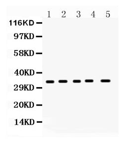 Anti-Superoxide Dismutase 4/CCS Antibody Picoband®