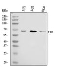 Anti-Tyrosinase/TYR Antibody Picoband®