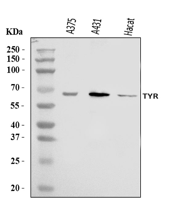 Anti-Tyrosinase/TYR Antibody Picoband®
