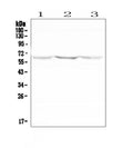 Anti-NOX2/gp91phox/CYBB Antibody Picoband®