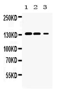 Anti-JAK1 Antibody Picoband®