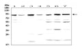 Anti-BAP1 Antibody Picoband®