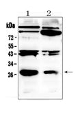 Anti-PDGF beta/PDGFB Antibody Picoband®