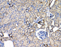 Anti-Leptin Receptor/LEPR Antibody