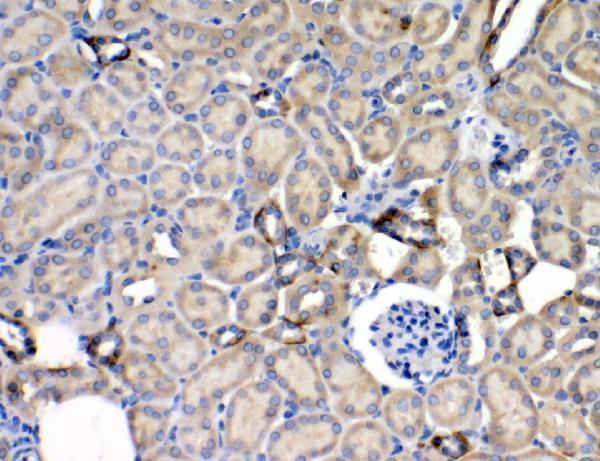 Anti-Leptin Receptor/LEPR Antibody
