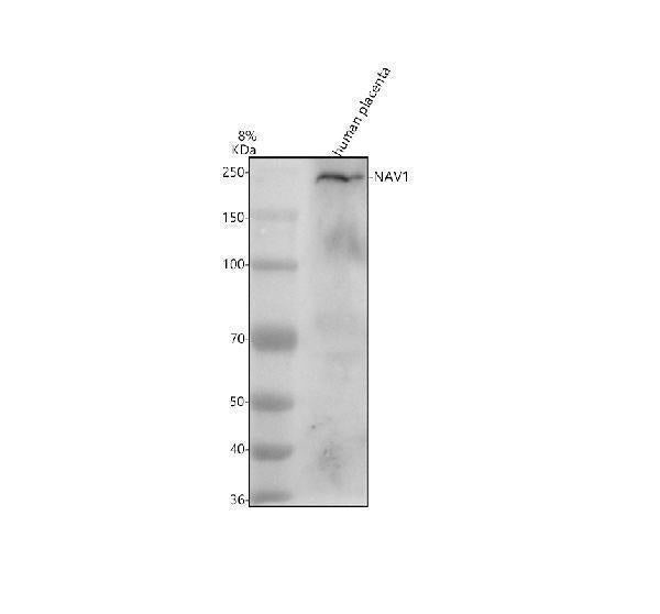 Anti-NAV1 Antibody Picoband®