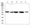 Anti-ETV6/Tel Antibody Picoband®