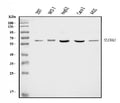 Anti-Dopamine Transporter/SLC6A3 Antibody Picoband®