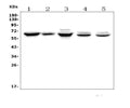 Anti-Angiopoietin-2/ANGPT2 Antibody Picoband®