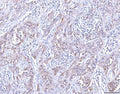 Anti-CCR7 Antibody