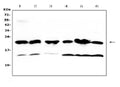 Anti-GST3/GST pi/Gstp1 Antibody Picoband®