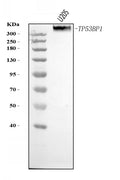 Anti-53BP1/TP53BP1 Antibody Picoband®
