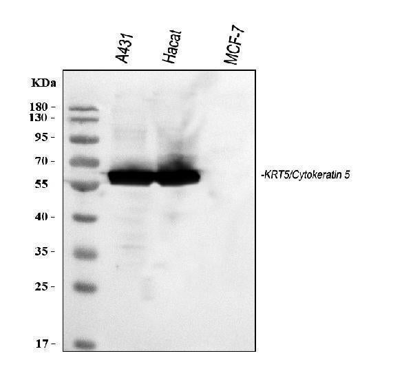 Anti-Cytokeratin 5/KRT5 Antibody Picoband®