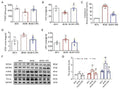 Anti-NADPH oxidase 4/NOX4 Antibody Picoband®