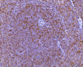 Anti-Ccl3 Antibody