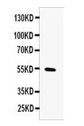 Anti-MMP13 Antibody Picoband®