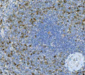 Anti-IL17A Antibody