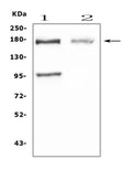 Anti-Niemann Pick C1/NPC1 Antibody Picoband®