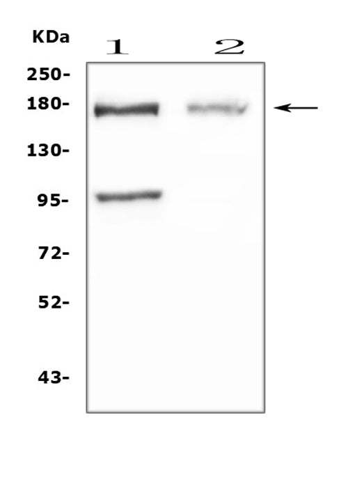 Anti-Niemann Pick C1/NPC1 Antibody Picoband®