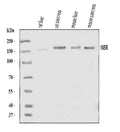 Anti-Insulin Receptor/INSR Antibody Picoband®