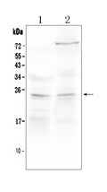 Anti-TIMP3 Antibody Picoband®
