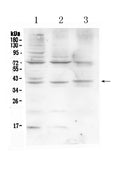 Anti-HFE Antibody Picoband®