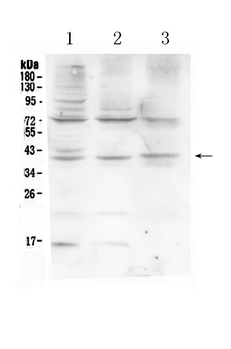 Anti-HFE Antibody Picoband®