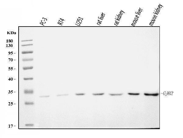 Anti-GJB2 Antibody Picoband®
