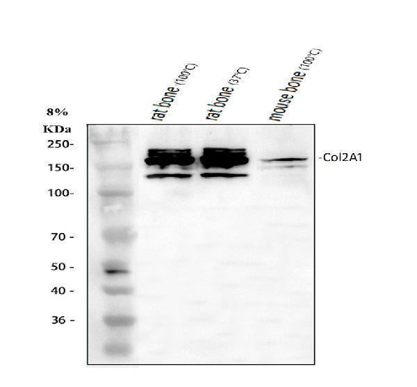 Anti-Collagen Type II/COL2A1 Antibody Picoband®