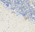 Anti-Sacsin Antibody