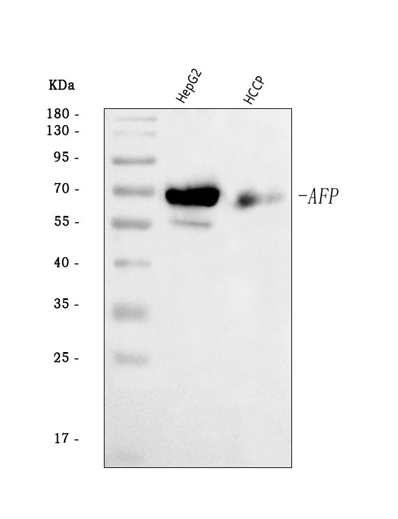 Anti-alpha 1 Fetoprotein/AFP Antibody Picoband®