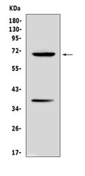 Anti-Alpha 1 Fetoprotein/Afp Antibody Picoband®