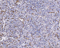 Anti-CXCL1 Antibody