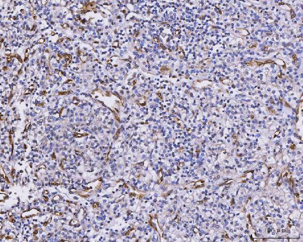 Anti-CXCL1 Antibody