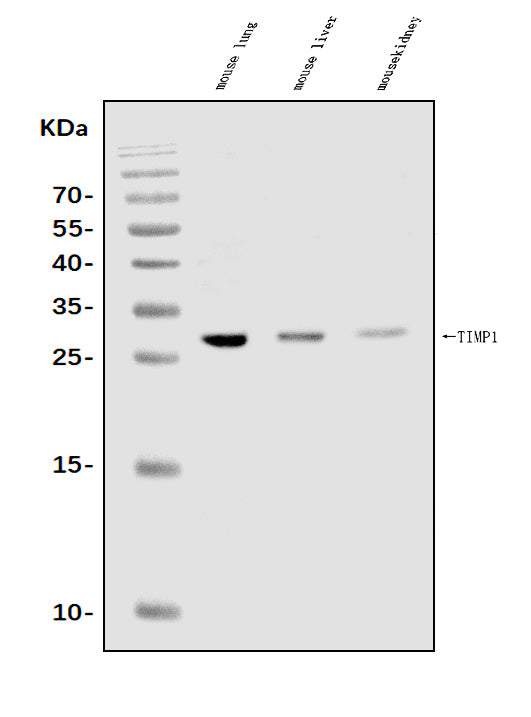 Anti-TIMP1 Antibody Picoband®