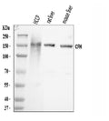 Anti-Factor H/CFH Antibody Picoband®