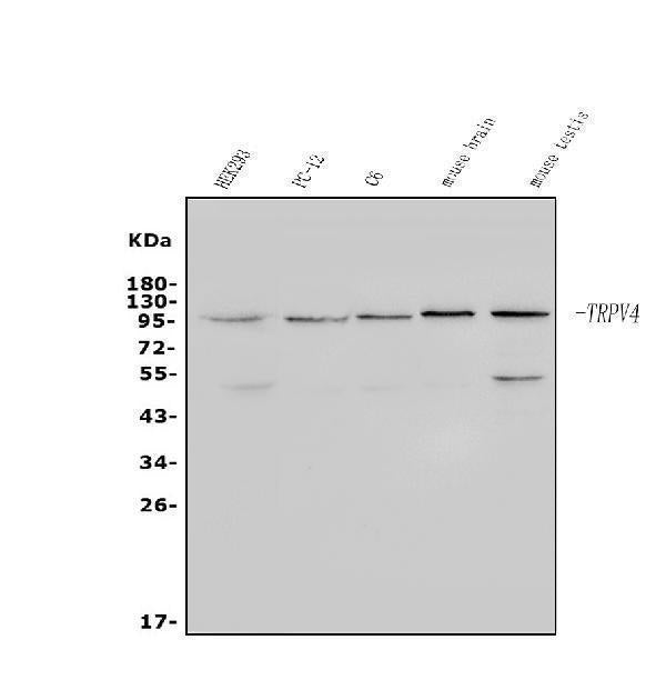 Anti-TRPV4 Antibody Picoband®