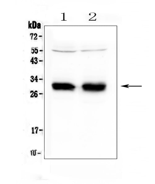 Anti-HLA Class II DRB1/HLA-DRB1 Antibody Picoband®