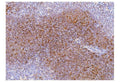 Anti-Cd2 Antibody