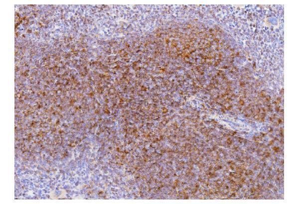 Anti-Cd2 Antibody