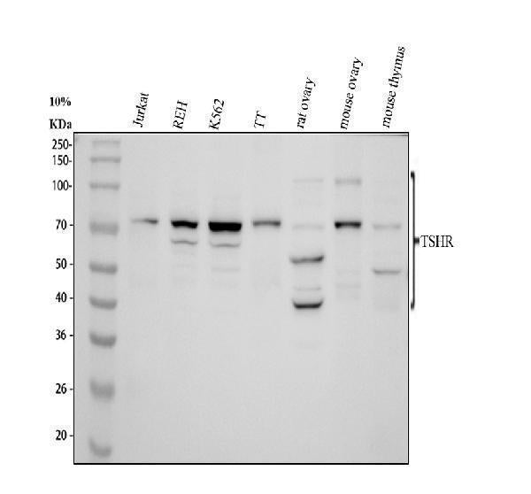 Anti-TSH Receptor/TSHR Antibody Picoband®