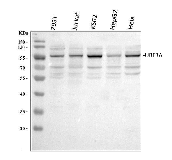 Anti-UBE3A Picoband® Antibody