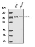 Anti-ADAMTS13 Antibody Picoband®