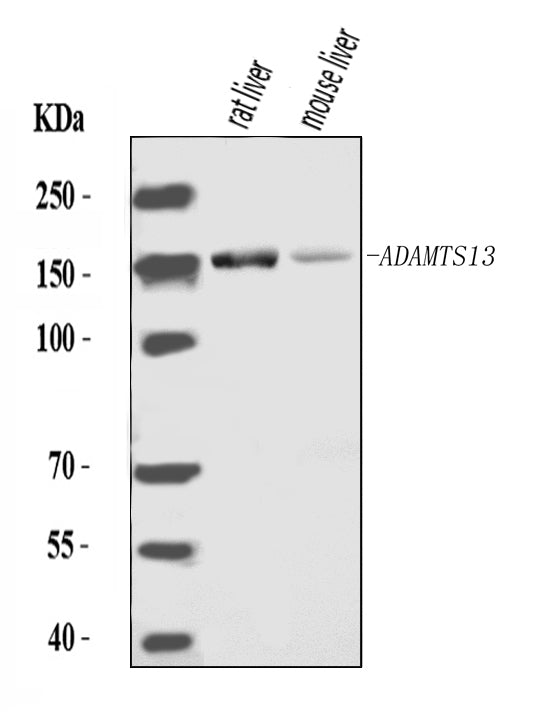 Anti-ADAMTS13 Antibody Picoband®