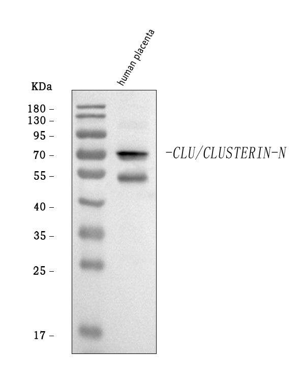 Anti-Clusterin/CLU Antibody Picoband®